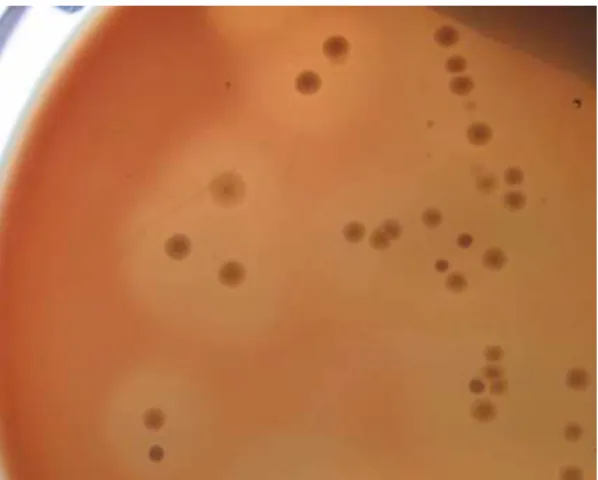 Figura  2.  Colônias  de  Clostridium  perfringens com duplo halo de hemólise em  ASA  suplementado  com  10%  de  sangue  desfibrinado de eqüino
