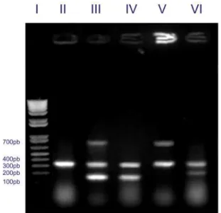 Figura  5a.  Fotodocumentação  de  gel  de  agarose  da  PCR  multiplex  de  material  genético  de  Clostridium  perfringens  A-E  (ATCC)