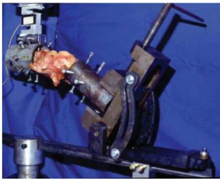 Figure 1 - Adjustable device with knee in 30º flexion