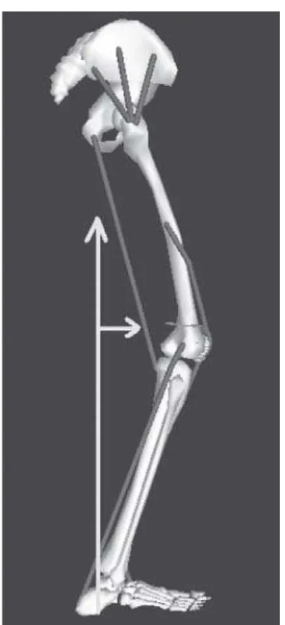 Figure 1 - Crouch Gait: increase knee flexion during stance phase and the external flexion moment