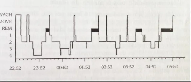 Figura 6: Hipnograma com a variação normal das fases do sono. In Paiva e Penzel.,2011 