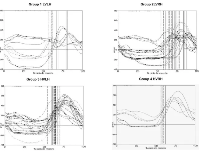 Figure 1 - Knee angular kinematics of the patients with consequences of ICVA and hemiparesis