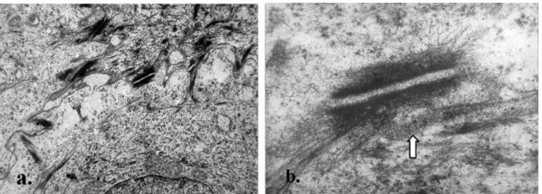 Figure 1 – Immediately after the experimental induction. a. Keratinocyte cytoplasmic vacuolization (x 28.000)
