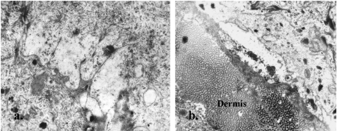 Figure 2 – One hour after the experimental induction a. Cytoplasmic and intercellular vacuolization (x 62.000)
