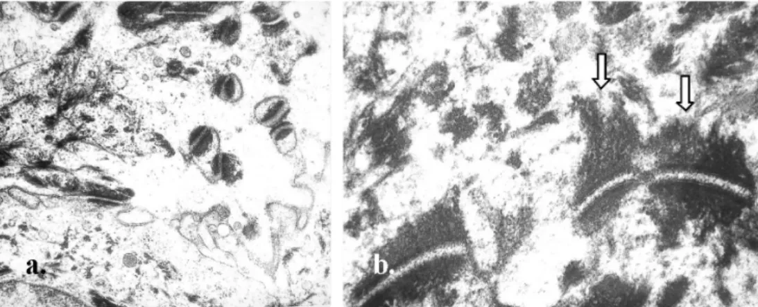 Figure 5 – Two hours after the experiment a. Intercelular vacuolization with free desmosomes (x 25.000)