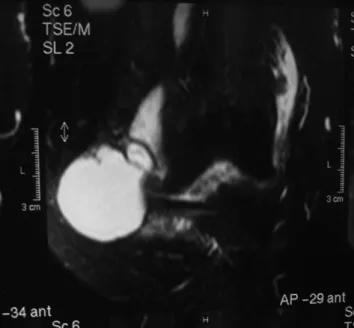Figure 4 - T1 axial view