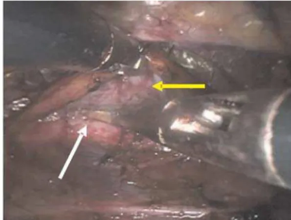Figure 2 - Plantar sudorometry and transmission of data by wireless sys- sys-tem