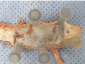Figure 3 - Macroscopic view of stent in pig aorta in Group M