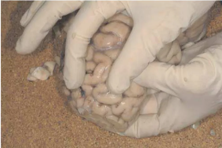 Figure 1- Dissection of the prefrontal cortex (BA46).