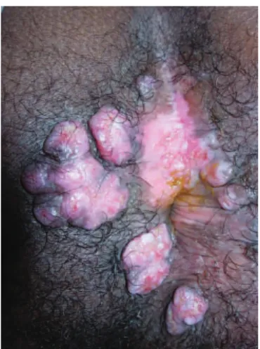 Figure 1 - Initial proctologic exam.