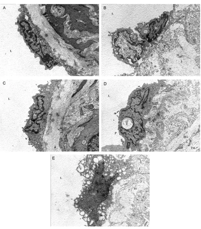 Figure 3 - A) A normal control rat aorta. B) An ovariectomized control rat aorta. C) The aorta of a rat fed with fresh soy oil