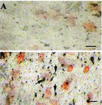 Figure 4 - CQ treatment induces extracellular matrix mineralization: Undif- Undif-ferentiated MSCs grown in basal media did not display deposition of calcium  salt in the extracellular matrix (A) even after 28 days of culture