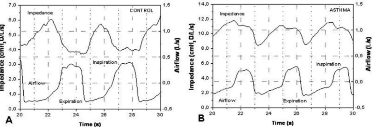 Figure 1 - Typical airflow and respiratory impedance analyzed in the control group (A) and asthmatic (B) individuals