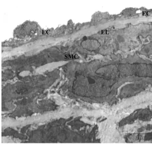 Figure 4 - Electron microscopic indings on the aorta of the diabetic rats  following eight weeks of study