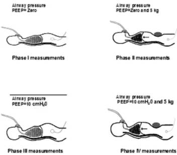 Figure 1 - Different phases of the protocol (I, II, III, IV)