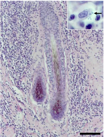 Figura  1.  Vulva;  cadela  assintomática.  Infiltrado  inflamatório  na  derme  predominantemente  perifolicular
