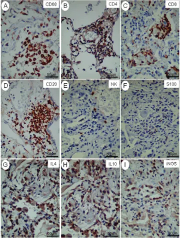 Table 4 - Semiquantitative analysis of cell immunophenotypes, cytokine-producing cells, iNOS and caspase.