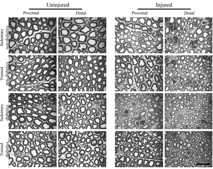 Figure 3 - Digitized images of semithin cross-sections obtained from the proximal and distal portions of the sciatic nerve from different groups in this study