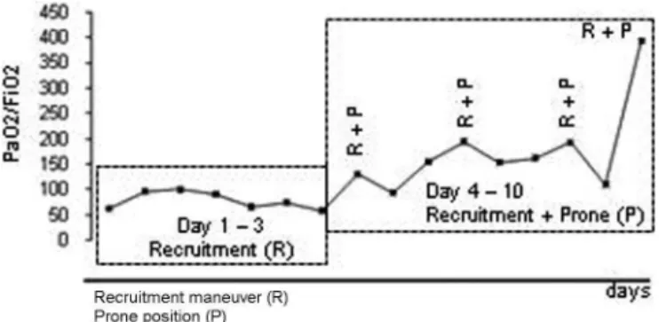 Figure 2 – Recruitment maneuver (R); Prone position (P).