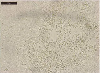 Figura 5: Efeito citopático que surgiu na décima passagem celular após inoculação do PBMC de um  animal  infectado  com  VLB  em  uma  das  amostras  isoladas  da  fazenda  X