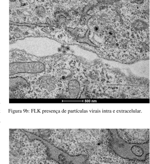 Figura 9b: FLK presença de partículas virais intra e extracelular. 2 