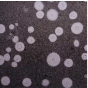 Fig. 5:    Fotomicrografia de    uma preparação    com    tinta    nanquim, mostrando    as    células    de    leveduras    esféricas, encapsuladas e de tamanho irregular de  C