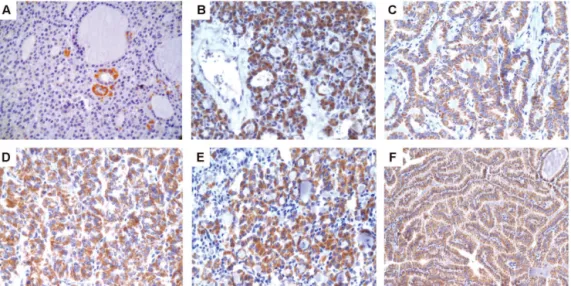 Table 1 - Quantitative analysis of NDRG1