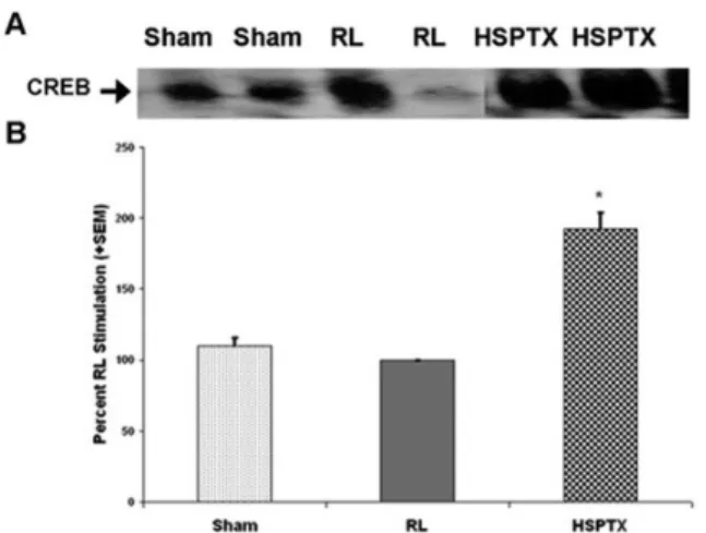 Figure  5  -  CREB-DNA  Binding Activity After  Hemorrhagic  Shock  and  Resuscitation