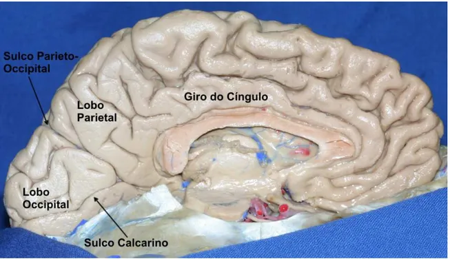 Figura 3. Delimitação do lobo occipital na face medial do hemisfério cerebral. O sulco parieto-occipital 