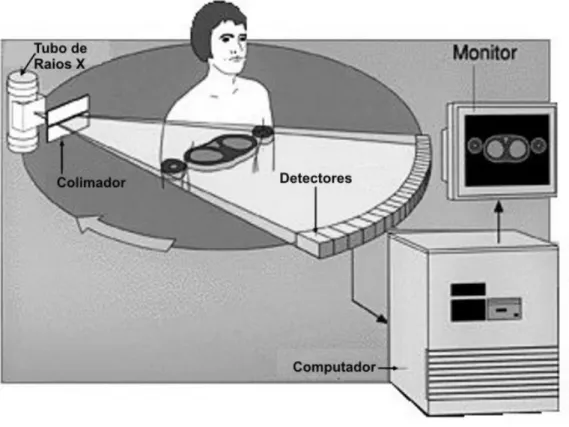Figura 15. Princípio de funcionamento dos aparelhos de tomografia computadorizada. O aparelho 