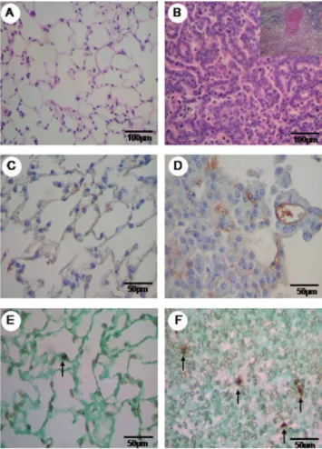 Figure 1 - Hematoxylin eosin (HE) staining of normal parenchyma of the  control group (A) and the urethane group, with an adenocarcinogenic area  and the detail of the adenocarcinogenic metastasis of the lymph node (B)