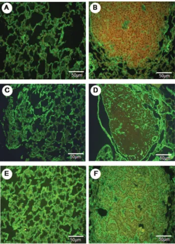 Figure  2  - The  normal  parenchyma  in  the  lungs  of  the  control  animals  shows a strong green birefringence of collagen V ibers (A)