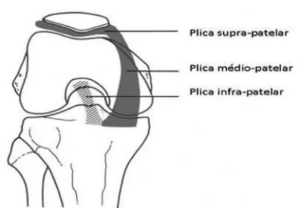 Figure 1 – Diagram of the three types of synovial plicae