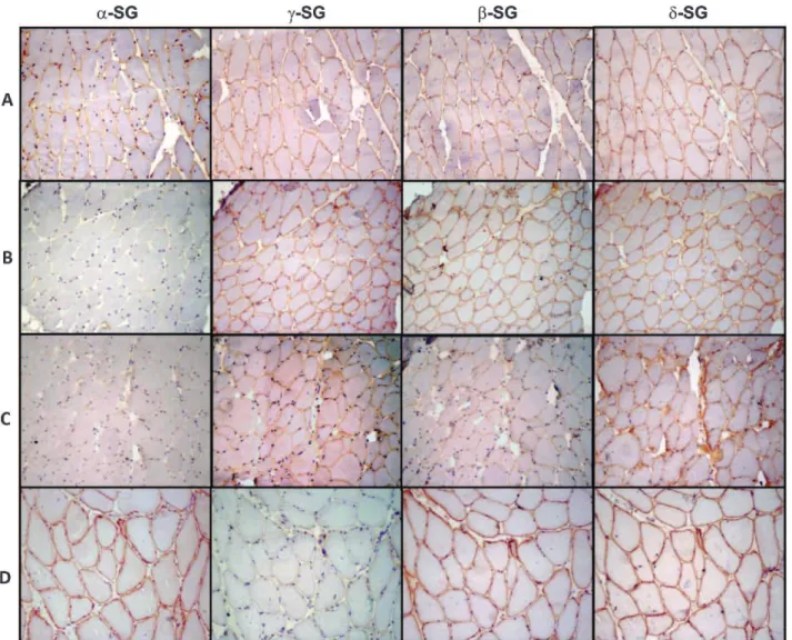 Figure 2 - Immunohistochemical preparations for alpha, gamma, beta and delta sarcoglycans (a-, c-, b- and d-SG, respectively)