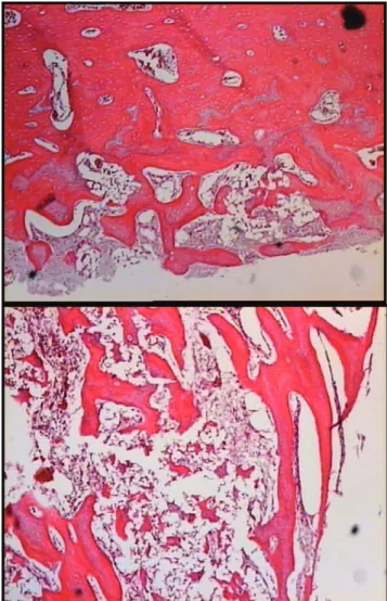 Table 3 - Bone tissue formed by area (%) after consolidation of defects filled with PRP + bTCP or BMC + bTCP, as measured using histomorphometry.