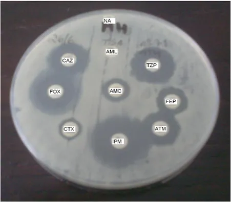 Fig. 3.1 – Disposição dos antimicrobianos no teste de duplo-disco.