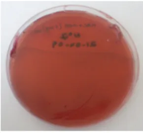 Fig. 4.1 – Crescimento de Enterobacteriacee de amostra de fezes em meio de cultura. 