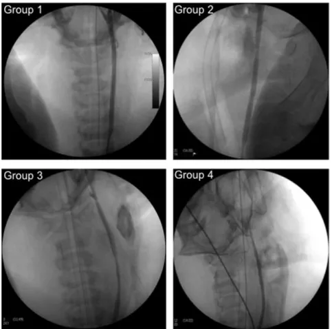 Table 1 - Doppler ultrasonography parameters (means ¡ standard deviation) before the lesion was created and after the placement of the covered stent and control arteriography with a perforating lesion model.