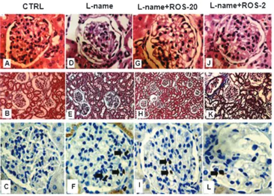 Figure 3 - Histological and immunohistochemical analysis. Representative glomerular sections stained with hematoxylin/eosin (A,D,G,J;