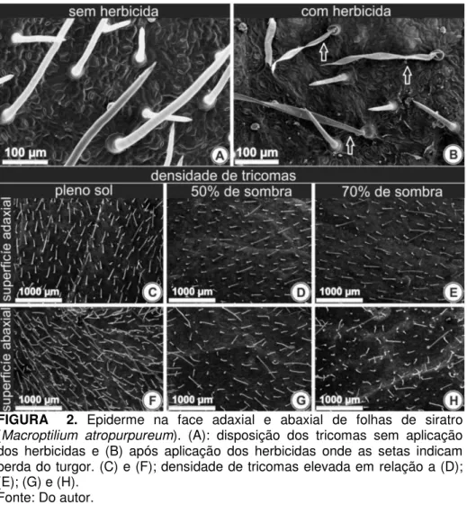 FIGURA    2.  Epiderme  na  face  adaxial  e  abaxial  de  folhas  de  siratro  (Macroptilium  atropurpureum)