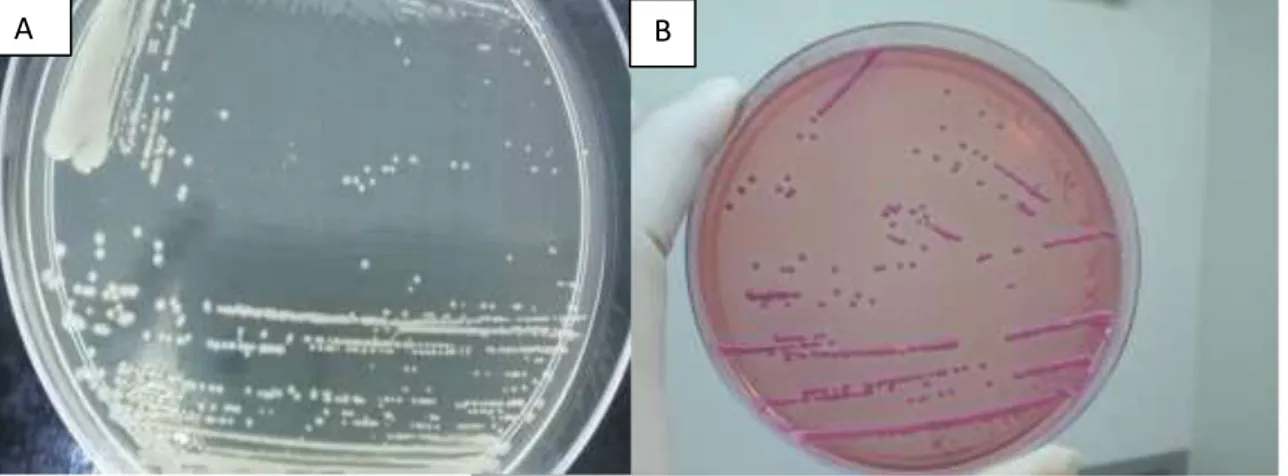 Figura  2  (A)  -  Colônias  de  Klebsiella  pneumoniae   crescendo  em  meio  LB  ágar  (Invitrogen)  apresentando  aspecto mucoide