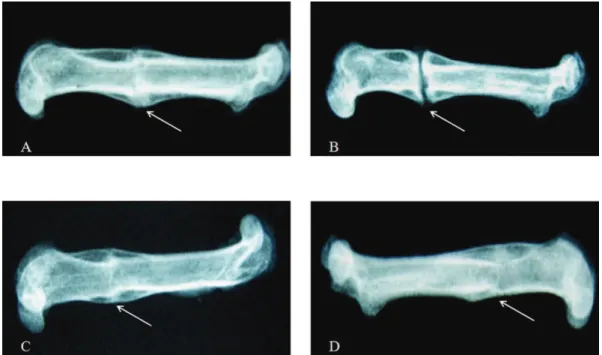 Table 3 - The callus stages based on the radiographic assessment. The values are expressed as the median with the range in parentheses.
