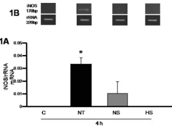Figure 3 shows that 4 h after the induction of pancreatitis, lipid peroxidation was significantly increased in the NT and NS groups ( P ,0.05 vs