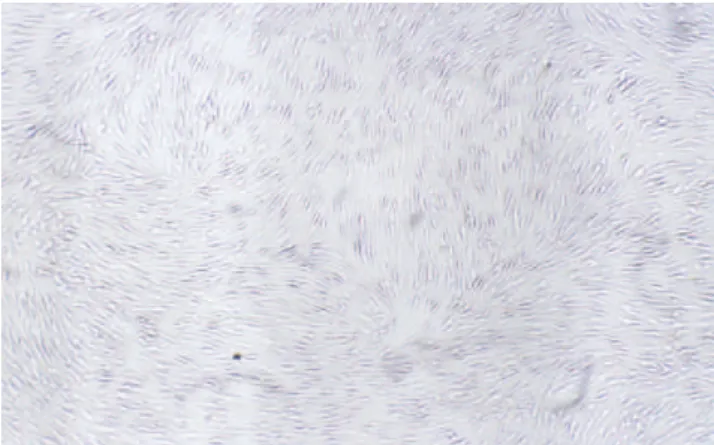 Figure 1 - The morphology of PPMCs. The cells exhibited a fibroblastoid morphology in a monolayer and then attained a stable, fibroblast-like morphology with no signs of granulation.