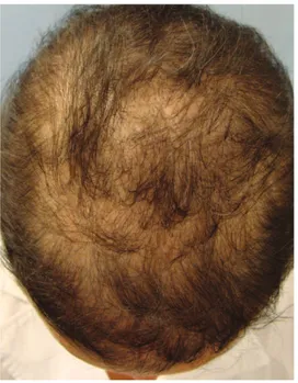 Figure 3 - Clinical picture of the case at 12 weeks of treatment.