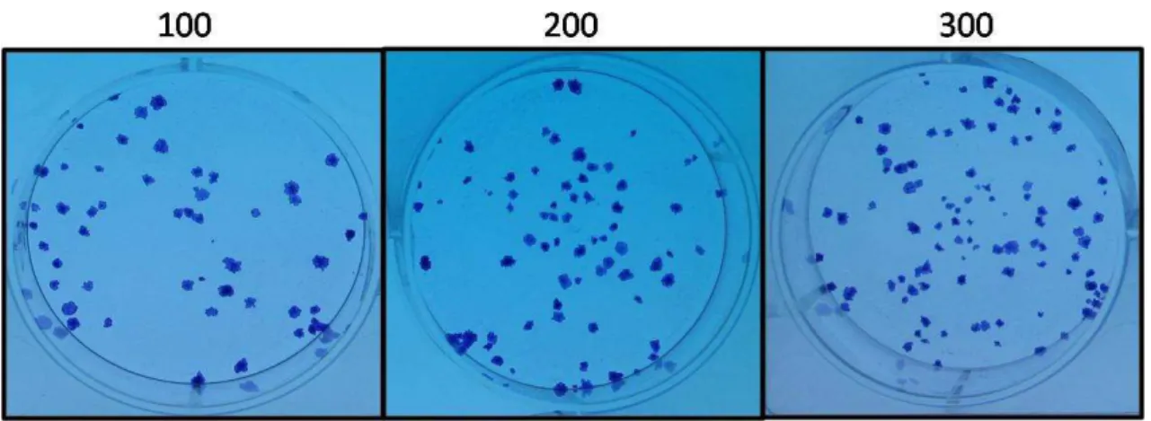 Figura  10  –  Visualização  das  colônias  formadas  a  partir  do  plaqueamento  de  células  de  câncer de mama não irradiadas nas densidades de 100, 200 e 300 células em placas de 6  poços