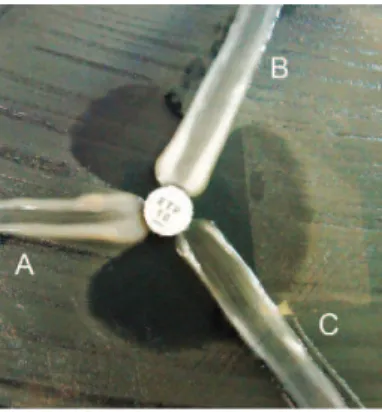 Figure 1 - Modified Hodge test (MHT) with ertapenem disks.