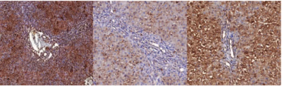 Figure 2 - Ratio between the anti-TGFb-stained area (mm 2 ) and total area (mm 2 ): PTX x CBDL, p = 0.032; PRED x CBDL, p = 0.089