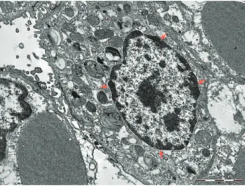 Figure 6 - Immunofluorescence microscopy (TUNEL) imaging for cell death analysis. Fluorescent-labeled cells (green) correspond to tissue death by apoptosis.