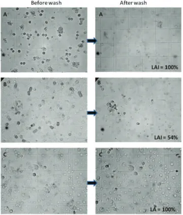 Figure 3 - Purified beta-lactoglobulin electroblotted on 0.45-mm pore-size nitrocellulose membranes after incubation with patient’s serum, primary antibody (goat IgG anti-human IgE), secondary antibody (HRP-conjugated rabbit anti-goat IgG) and DAB revelati
